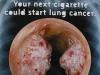 Philip Morris заплатит 13,8 миллиона долларов за смерть заядлой курильщицы