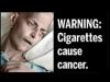 На пачках американских сигарет появятся изображения трупов и умирающих пациентов