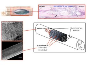 Революционная технология поставит парализованных людей на ноги