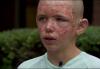 12-летний мальчик вынес горящую бабушку из горящего дома