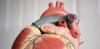 Прорыв в медицине: австралийским врачам удалось осуществить революционную операцию по пересадке мертвого донорского сердца. Их метод увеличит на 30% количество спасенных жизней