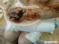 Фотографии от медслужбы ополчения.