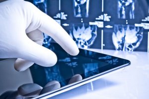 Изобретатель из Петербурга придумал перчатку, заменяющую слух и голос