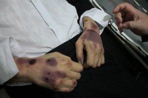 Эксперты ООН заявили, что Киев нарушает Конвенцию против пыток