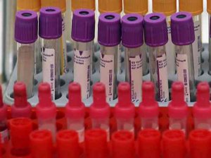 Холеру в украинском Измаиле скрыть будет невозможно  (Эксперт: «В первую очередь, беспокоиться надо румынам, молдаванам. Но инфекция может попасть и к нам»)