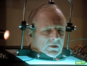 Проведена успешная пробная операция по пересадке головы (на животных)