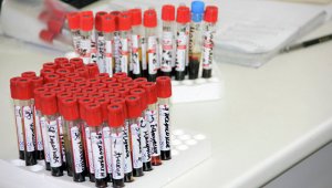 Нью-Йорк оказался очагом эпидемии ВИЧ, выяснили ученые