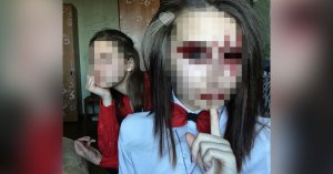 Генпрокуратура утвердила обвинение в отношении хабаровских живодёрок