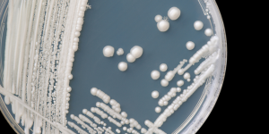 В США набирает обороты смертельная грибковая инфекция, от которой нет лекарства