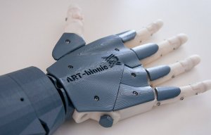 В ДВФУ представили прототип биопротеза руки нового поколения