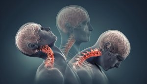Китайской пациентке вживили напечатанные на 3D-принтере позвонки