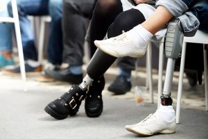 Обрезанные наглухо. И это им ещё мельдоний не давали (Британские паралимпийцы подрезали себе конечности, чтобы выступать против более слабых соперников. Да-да, у которых вообще нет рук и ног)