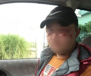 На западе Украины приехавших по грибы туристов избили всем селом