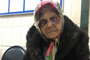 Избитую до полусмерти старушку все принимали за бомжа. В итоге женщина чуть не замерзла под забором в Домодедово