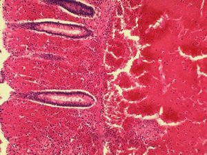 Роспотребнадзор и Ростуризм предупредили россиян о вспышке сибирской язвы в Турции