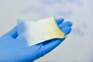 Молодые специалисты из НИТУ «МИСиС» разработали «живые» бинты
