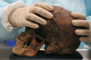 В зубах древнего человека нашли смертоносный вирус