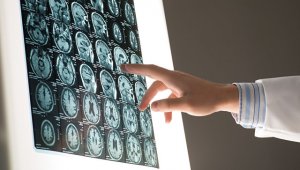 Создана программа с высокой долей вероятности  прогнозирующая болезнь  Паркинсона