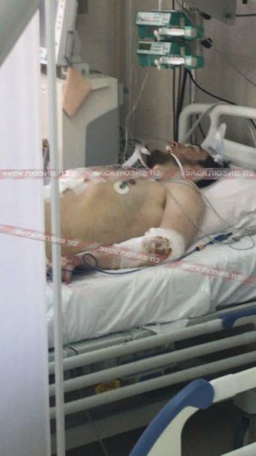 В Кузьминках на Волгоградском проспекте 105 двух ППСников порезал чеченец при проверке документов