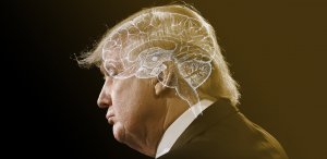 The Atlantic (США): можно ли говорить о неврологических проблемах Дональда Трампа? После года наблюдений за поведением  Президента США автор статьи считает необходимым его тщательное обследование