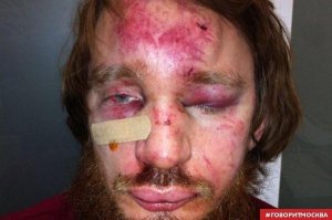 Помощнику постпреда Кадырова в Крыму грозит статья о похищении человека