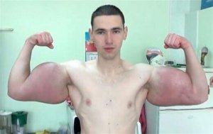 Руки-Базуки просит у подписчиков деньги на операцию по удалению синтола