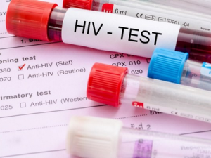 Генная модификация позволила излечить животных от ВИЧ. Люди на очереди.