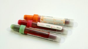 "Где вы нашли этого врача?": Доктор Мясников через СМИ обратился к терапевту, рискнувшей сказать правду о ненужных анализах