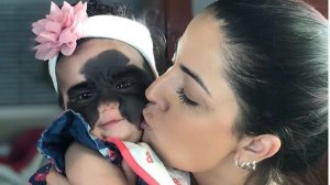 "Все думают, что я сумасшедшая, раз лечу в Россию ......"  (Daily Mail: в России врачи взялись избавить американскую девочку от метки Бэтмена)