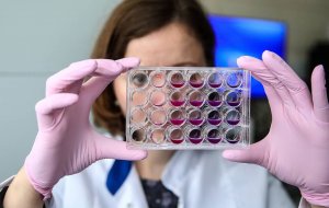 Виагра выманила кроветворные клетки из костного мозга в кровь