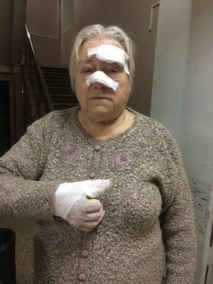 В Твери на женщину упала крыша остановки. В больнице её отказались принять и отправили пешком в поликлинику