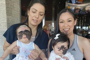 Еще одна девочка из США прилетает к врачам в Краснодар удалять пятно