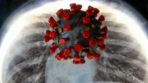 Число бессимптомных больных COVID-19 в Петербурге увеличилось до 70%