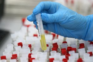 Почему Россия отказывается от массового тестирования граждан на иммунитет к коронавирусу