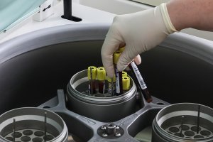 Ученые РФ представят результаты сравнения тест-систем на коронавирус