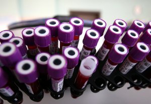 ВОЗ позитивно оценила масштабы тестирования на коронавирус в России