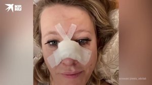 Ксения Собчак сломала нос (Телеведущая показала себя на больничной койке)