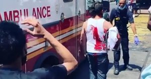 Новости Нью-Йорка: мужчина ходил с ножом в голове после нападения грабителей в Нью-Йорке (Гарлеме)