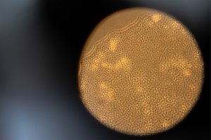 Ученые нашли способ исправить "коронавирусные" повреждения легких