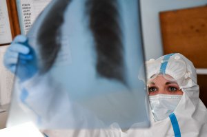 Главный онколог РФ назвал факторы, повышающие риск развития рака