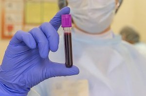 Треть американцев отказалась бы от вакцины против коронавируса, даже если бы она была бесплатной  (Выбор, оказалось, зависит от политических убеждений)