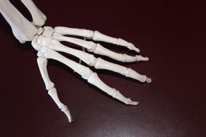 В Туле ученые разработали искусственные кости