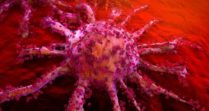 Золотые наночастицы выжигают рак изнутри: новая терапия