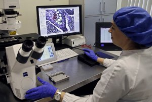 В Сколково разработали тест для поиска мутаций в опухолях