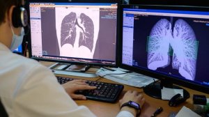 Патологоанатомы показали, что COVID-19 делает с органами человека