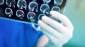 У дипломатов и военных США нашли повреждения мозга — это опасно?  (Более 130 человек пожаловались на мучительные головные боли и странные мысли. ЦРУ принялось за расследование дела)