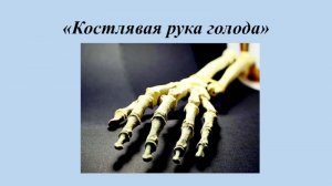[Бедность победили] В Верховной раде заявили: «Эпоха бедности закончилась, началась эпоха голода и нищеты. Мы самая недоедающая страна в Европе»