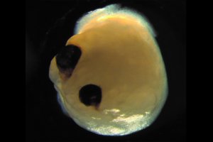 Ученые вырастили из стволовых клеток мини-мозг, на котором появились «глаза»