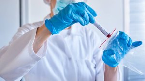 Многие жители Республики Коми не могут позволить себе пройти ПЦР-тестирование на коронавирус в частных лабораториях региона