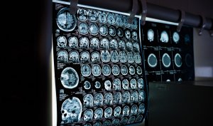 МРТ-сканирование и технология искусственного интеллекта действительно могут прочесть, о чём мы думаем - последствия ужасают